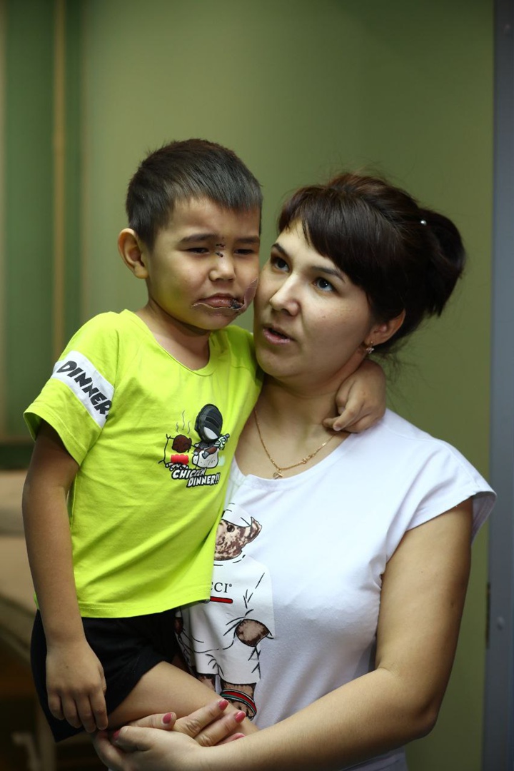 В Челябинске провели серию операций мальчику, оставшемуся без части губы