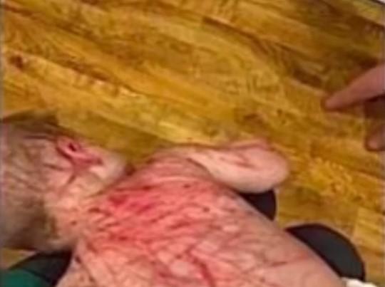 Фото В микрорайоне Парковый стафф исцарапал детей
