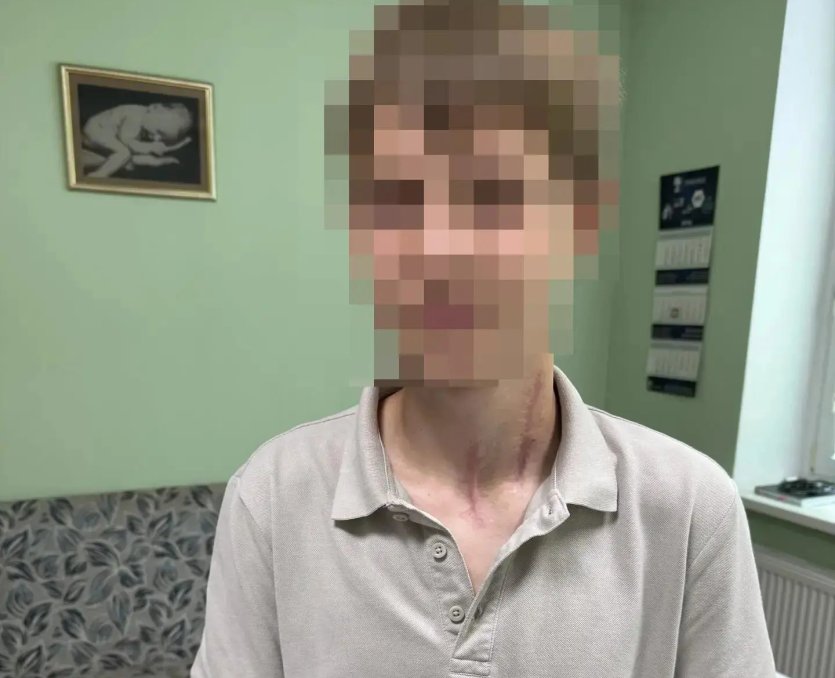 Фото Рассекло шею до позвоночника: в Челябинске спасли юного мотоциклиста