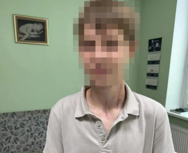 Фото Рассекло шею до позвоночника: в Челябинске спасли юного мотоциклиста