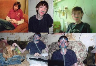 Фото Молодой человек, больной муковисцидозом, нуждается в помощи